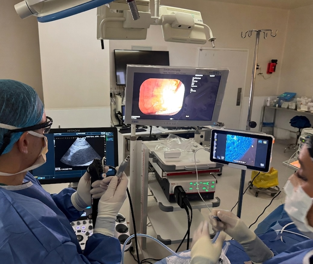 Procedimiento CryoEBUS: biopsia mediastínica con criosonda guiada por ultrasonido endobronquial